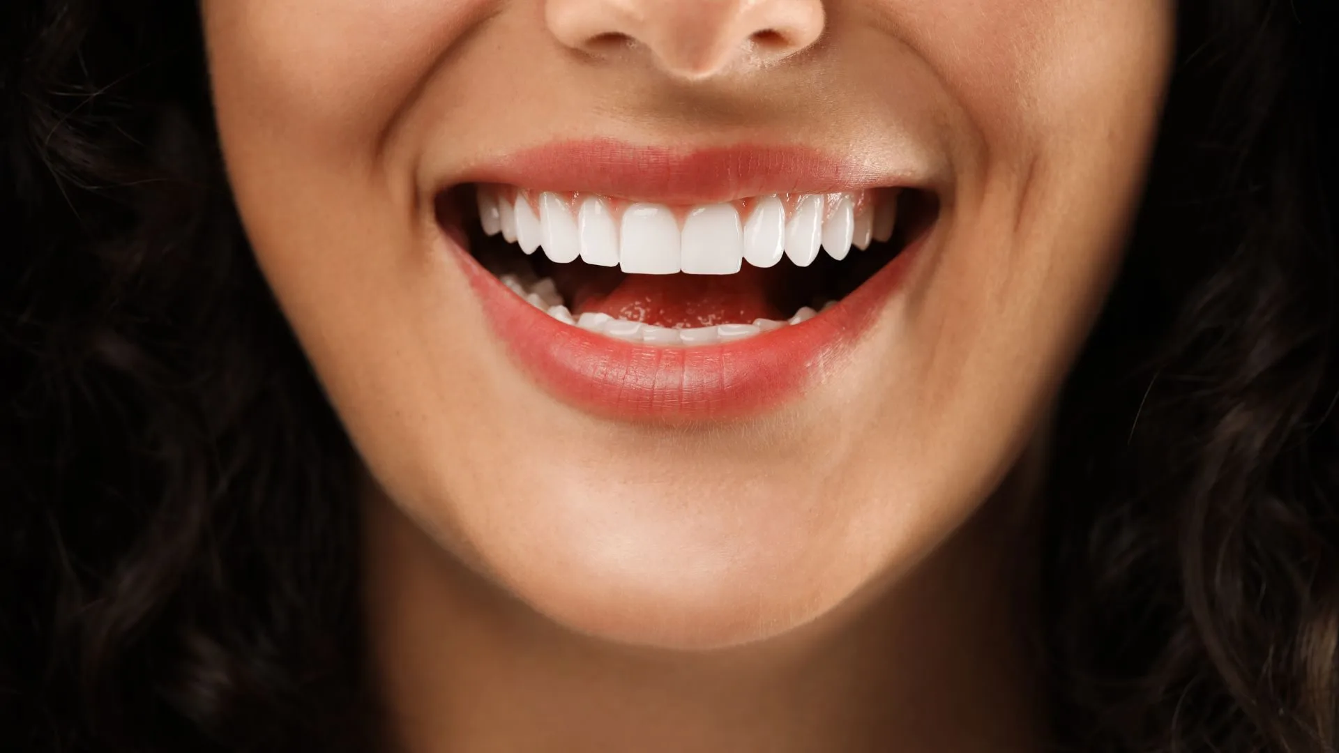 Bone grafting and dental implants in Smeaton Grange in ToothSavers™
