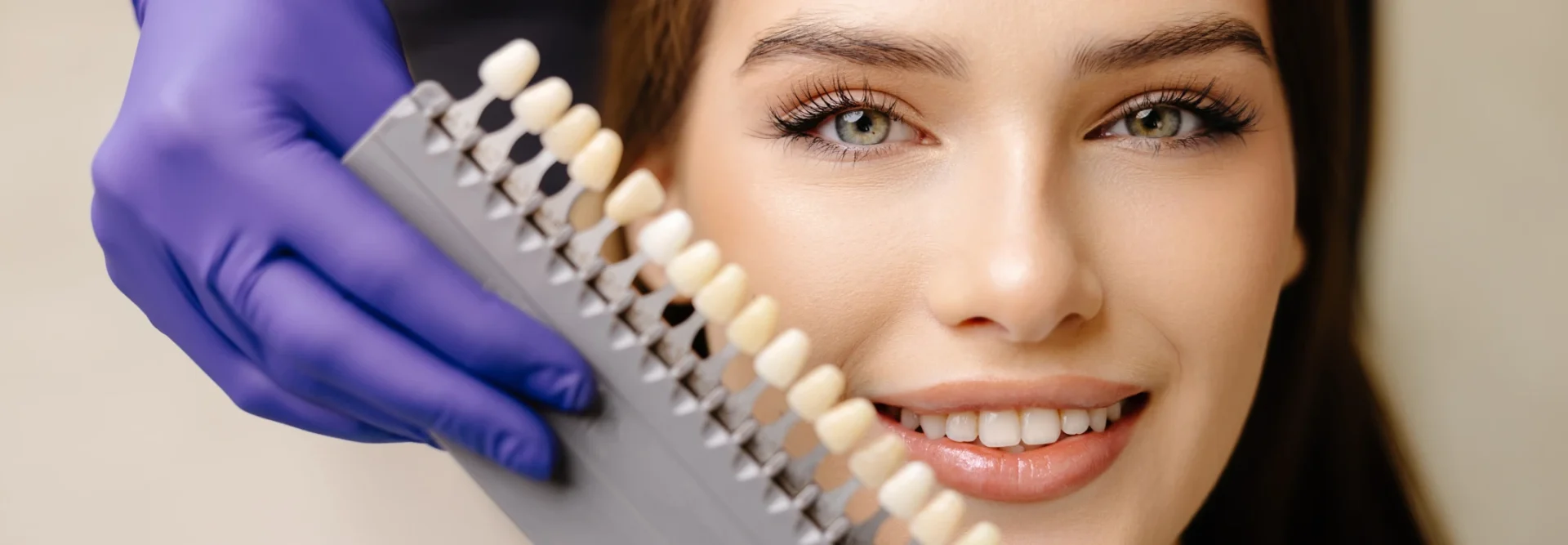 Cosmetic Dentistry in Mount Annan - Tooth Savers