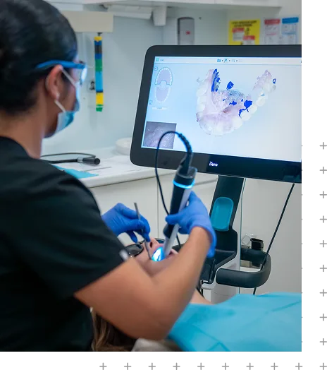 Digital Scanner IiTero) at ToothSavers in Campbelltown, Narellan & Mount Annan