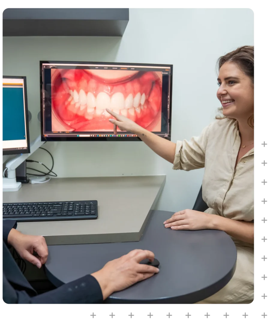 Cosmetic Bonding Sculpting at ToothSavers in Campbelltown, Narellan & Mount Annan