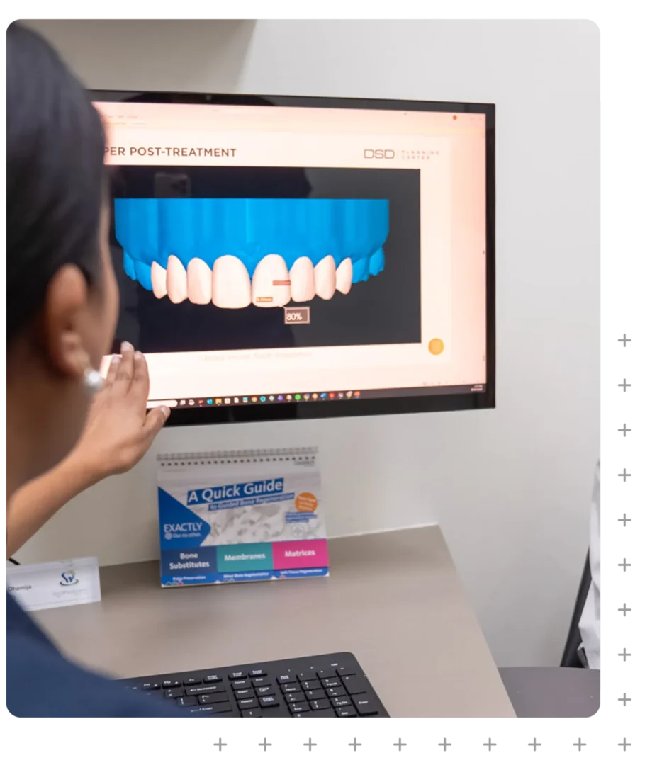 Digital Smile Design at ToothSavers in Campbelltown, Narellan & Mount Annan